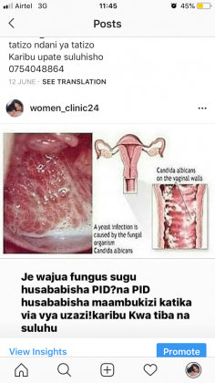 Fertility clinic for men’s na women’s